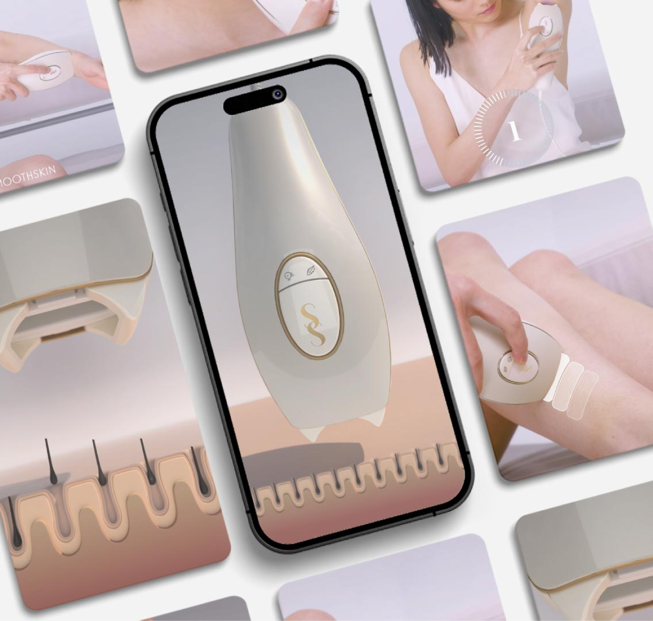 Smoothskin laser hair remover case study image